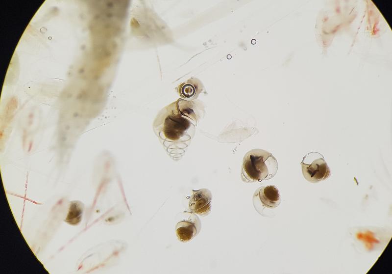 Under the microscope: Subpolar species Limacina retroversa collected in the Nansen Basin (station P6)